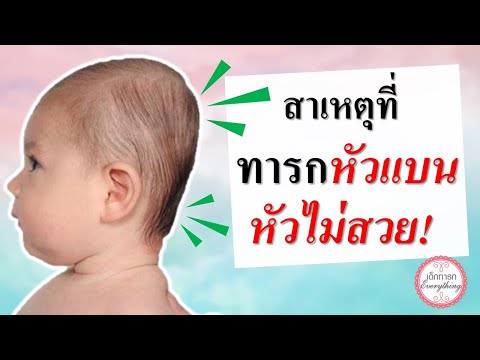 การดูแลทารก : สาเหตุที่ทารกหัวแบน หัวไม่สวย! | ทารกหัวทุย | เด็กทารก Everything